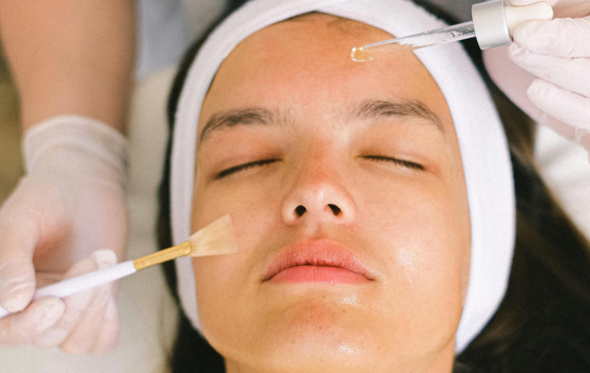 Treatment image